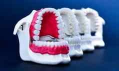 牙医矫正牙齿模型