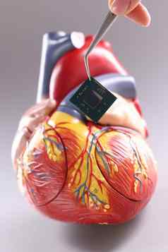 模型心心脏起搏器形式芯片