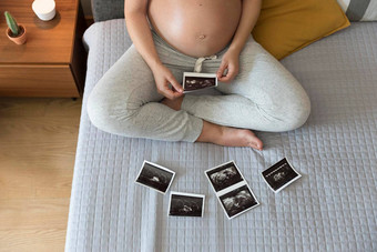 怀孕了女人超声波图片