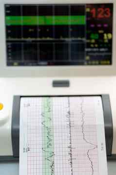 电子cardiotocography机监控胎儿心宫缩子宫印刷心电图报告未来心电图劳动病房怀孕医疗诊断设备