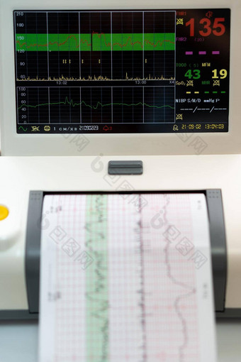 电子cardiotocography机监控胎儿心宫缩子宫印刷心电图报告未来心电图劳动病房怀孕医疗诊断设备