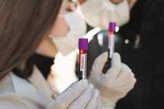 手男人。女人持有测试管血样本测试管血科维德分析实验室测试病人血积极的血测试结果