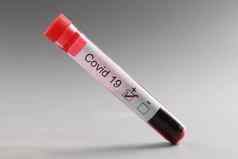 测试管冠状病毒积极的血结果灰色背景