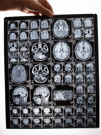 核磁共振扫描图像大脑持有图片手