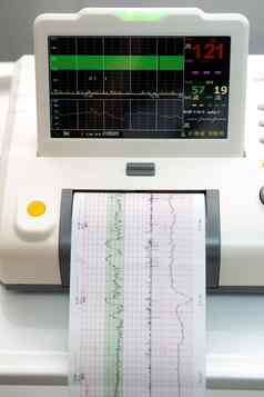 电子cardiotocography机监控胎儿心宫缩子宫印刷心电图报告未来心电图劳动病房怀孕医疗诊断设备