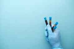 手蓝色的医疗手套持有血测试管