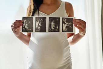婴儿肖像拍摄无法辨认的怀孕了女人持有系列超声波图片前面窗口首页