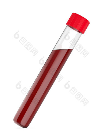 测试管血