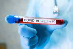 积极的血感染样本测试管科维德冠状病毒实验室科学家持有检查分析病人医院
