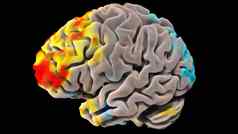 医疗插图人类大脑神经元活动