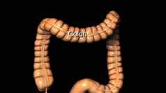 结肠小肠镜肠肠癌症肿瘤可见