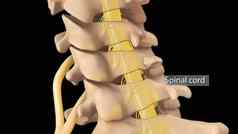 解剖视图颈脊柱椎间disc-compressive神经根脱垂
