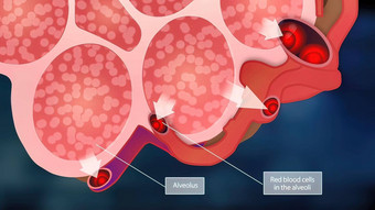 <strong>肺泡</strong>红色的血细胞