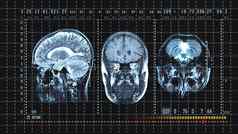 大脑断层摄影术核磁共振扫描专业医疗设备