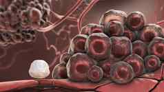 癌症细胞攻击白色血细胞