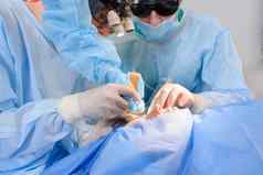 激光眼睑整容术塑料手术操作纠正缺陷畸形四肢不全眼皮