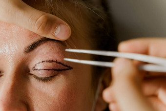 眼睑整容术标记特写镜头脸塑料手术操作修改眼睛地区脸医疗诊所医生塑料化妆品操作