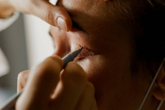 眼睑整容术标记脸美丽的女塑料手术操作修改眼睛地区脸医疗诊所医生塑料化妆品操作