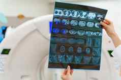 仪器研究诊断方法电脑断层摄影术x射线图片手背景