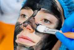 皮肤科医生涂片黑色的面具脸激光photorejuvenation碳剥皮肤病学美容外科手术激光