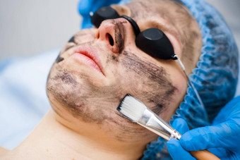 皮肤科医生<strong>涂片</strong>黑色的面具脸激光photorejuvenation碳剥皮肤病学美容外科手术激光