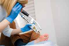 激光删除疣脚医疗皮肤病学的手术诊所