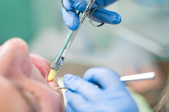 牙医注入麻醉注射器病牙齿病人龋齿治疗