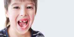 微笑孩子显示洞行牙齿口切牙下降了关闭照片牙龈牙医横幅复制空间