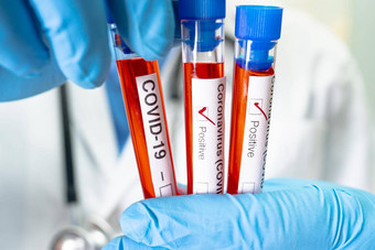 积极的血感染样本测试管科维德冠状病毒实验室科学家持有检<strong>查分</strong>析病人医院