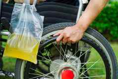 亚洲残疾女人尿液袋轮椅
