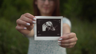 年轻的怀孕了女人持有超声波图片婴儿手女孩自然