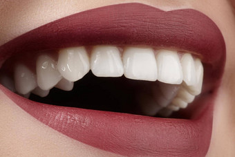 宽微笑年轻的美丽的女人完美的健康的白色牙齿牙科<strong>美白</strong>ortodont护理牙健康
