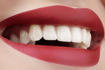美丽的微笑美白牙齿牙科照片宏特写镜头完美的女口唇部护理鲁汀