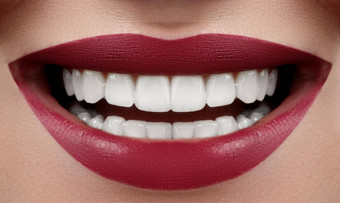 美丽的微笑<strong>美白</strong>牙齿牙科照片宏特写镜头完美的女口唇部护理牙护理鲁汀