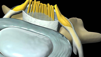 脊髓狭窄缩小骨运河神经脊髓绳通过