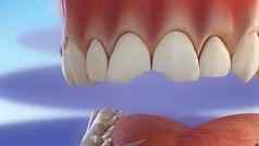 过程凿损坏的牙齿