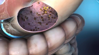 幽门螺杆菌幽门克微量需氧的细菌落定胃