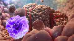 插图免疫细胞摧毁癌症细胞