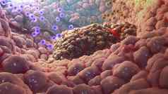 插图免疫细胞摧毁癌症细胞