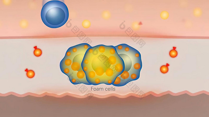 脂肪细胞巨噬细胞场脂肪细胞高质量渲染脂肪细胞胆固醇细胞