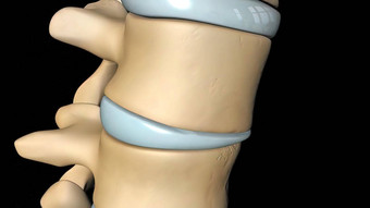 脊髓绳正常的椎间阀瓣