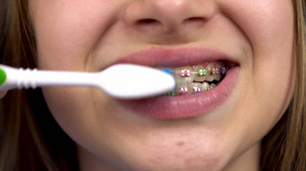 女孩牙套刷牙齿牙刷特写镜头女孩彩色的牙套牙齿牙齿清洁