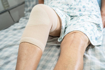 亚洲高级上了年纪的夫人女人病人膝盖支持疼痛联合床上护理医院病房健康的强大的医疗概念