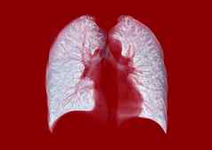 胸部肺呈现图像红色的背景诊断肺结核科维德