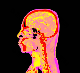 色彩斑斓<strong>的</strong>血管造影术大脑进行合作。大脑矢状面视图剪裁路径