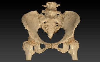 扫描<strong>骨盆骨</strong>臀部联合呈现图像孤立的黑色的背景剪裁路径