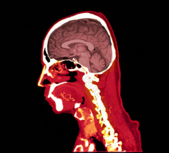 色彩斑斓的血管造影术大脑进行合作。大脑矢状面视图剪裁路径