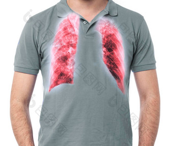 胸部x射线x射线图像人类胸部肺红色的区内部胸腔显示肺结核