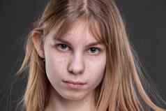 脸十几岁的女孩青春痘特写镜头灰色的背景