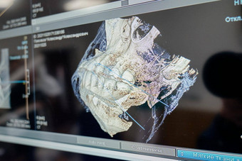x射线下巴牙齿电脑监控检查口服腔数字医疗设备